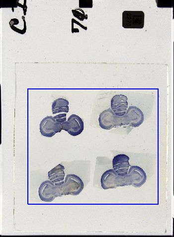 Media type: image; Special Collections 3298   shows specimen_part histological serial section;